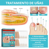 Parches Antihongos para Uñas de Pies